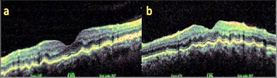 Click here to view Large Figure 4