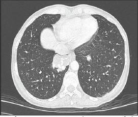 Click here to view Large Figure 2