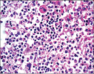 Click here to view Large Figure 2