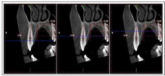 Click here to view Large Figure 6
