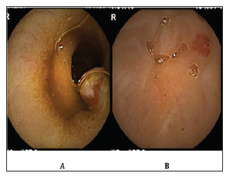 Click here to view Large Figure 1