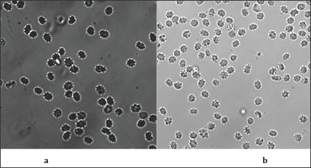 Click here to view Large Figure 4 biomedres-openaccess-journal-bjstr
