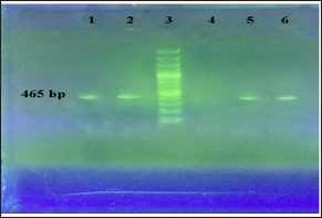 Click here to view Large Figure 1 biomedres-openaccess-journal-bjstr