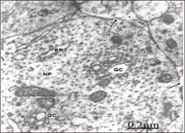 Click here to view Large Figure 1 biomedres-openaccess-journal-bjstr