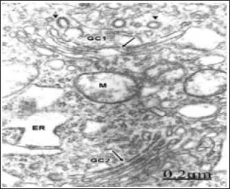 Click here to view Large Figure 1 biomedres-openaccess-journal-bjstr