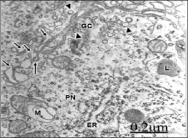 Click here to view Large Figure 1 biomedres-openaccess-journal-bjstr