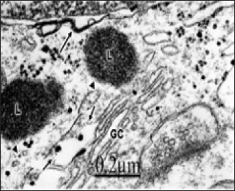 Click here to view Large Figure 1 biomedres-openaccess-journal-bjstr