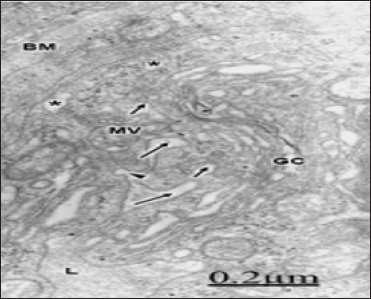 Click here to view Large Figure 1 biomedres-openaccess-journal-bjstr
