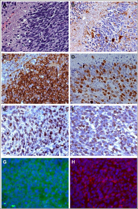 Click here to view Large Figure 1 biomedres-openaccess-journal-bjstr