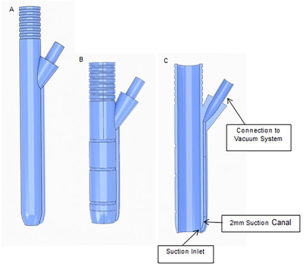 Click here to view Large Figure 1 biomedres-openaccess-journal-bjstr