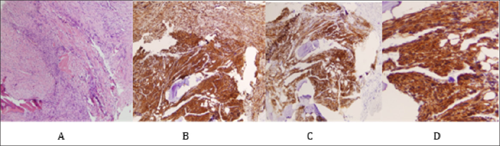 Click here to view Large Figure 6 biomedres-openaccess-journal-bjstr