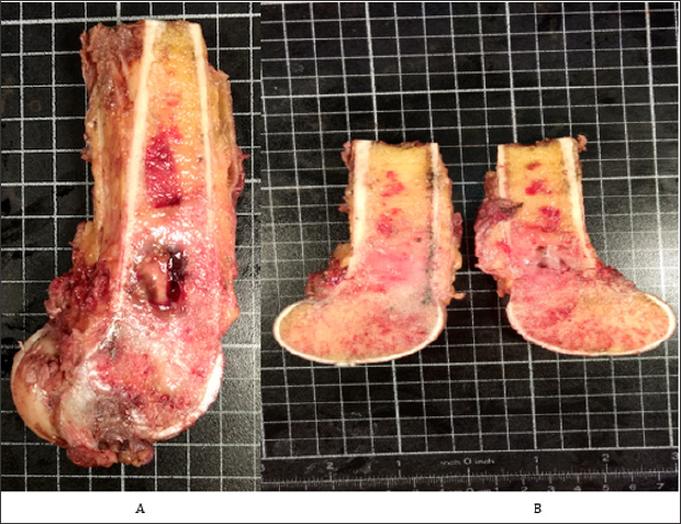 Click here to view Large Figure 7 biomedres-openaccess-journal-bjstr