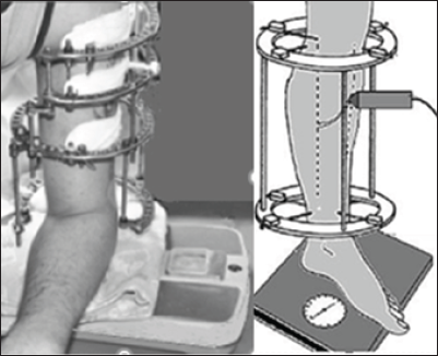 Click here to view Large Figure 1 biomedres-openaccess-journal-bjstr