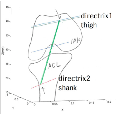 Click here to view Large Figure 1 biomedres-openaccess-journal-bjstr
