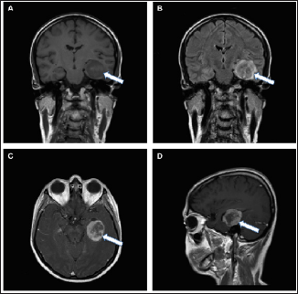 Click here to view Large Figure 3 biomedres-openaccess-journal-bjstr
