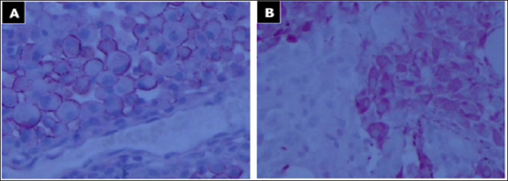 Click here to view Large Figure 3 biomedres-openaccess-journal-bjstr