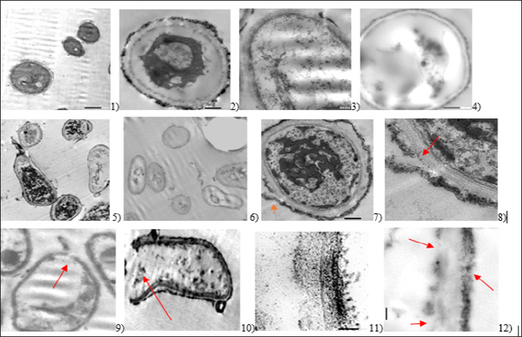 Click here to view Large Figure 3 biomedres-openaccess-journal-bjstr