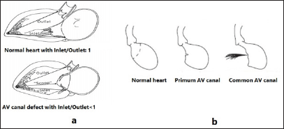 Click here to view Large Figure 1 biomedres-openaccess-journal-bjstr