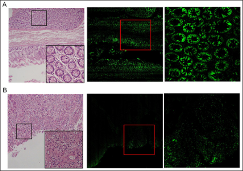 Click here to view Large Figure 1 biomedres-openaccess-journal-bjstr