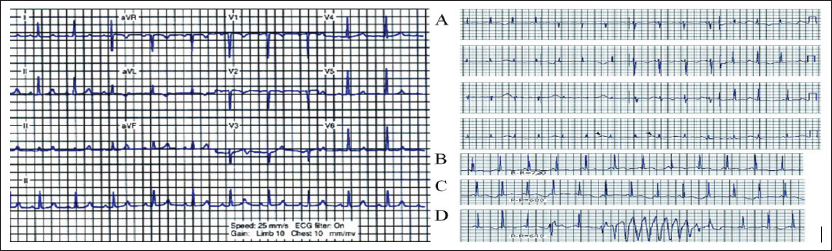 Click here to view Large Figure 1 biomedres-openaccess-journal-bjstr