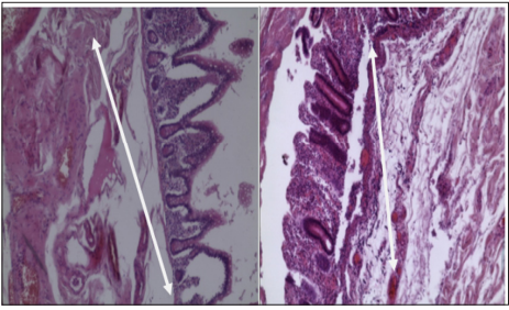 Click here to view Large Figure 1 biomedres-openaccess-journal-bjstr