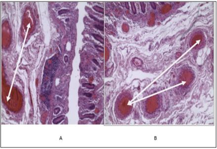 Click here to view Large Figure 2 biomedres-openaccess-journal-bjstr