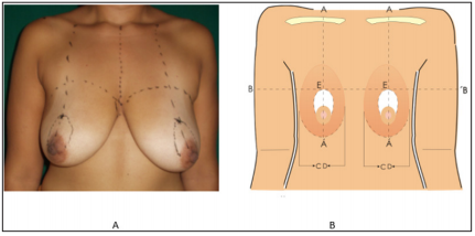 Click here to view Large Figure 4 biomedres-openaccess-journal-bjstr