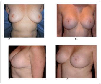 Click here to view Large Figure 12 biomedres-openaccess-journal-bjstr