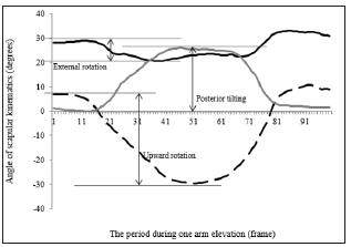 Click here to view Large Figure 1 biomedres-openaccess-journal-bjstr
