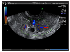 Click here to view Large Figure 1 biomedres-openaccess-journal-bjstr