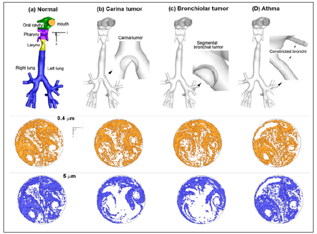Click here to view Large Figure 1 biomedres-openaccess-journal-bjstr