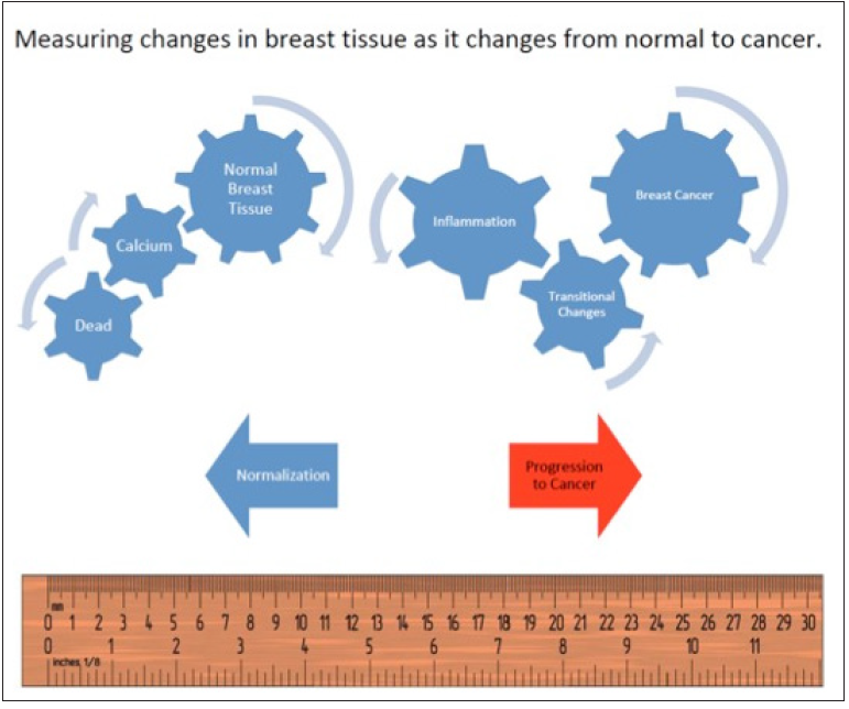 Click here to view Large Figure 1 biomedres-openaccess-journal-bjstr