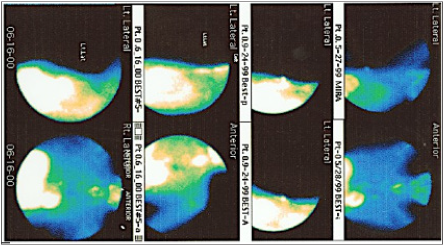 Click here to view Large Figure 2 biomedres-openaccess-journal-bjstr