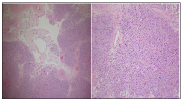 Click here to view Large Figure 1 biomedres-openaccess-journal-bjstr