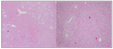 Click here to view Large Figure 2 biomedres-openaccess-journal-bjstr