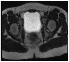 Click here to view Large Figure 1 biomedres-openaccess-journal-bjstr