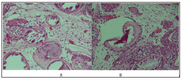 Click here to view Large Figure 2 biomedres-openaccess-journal-bjstr