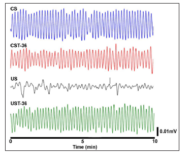 Click here to view Large Figure 2 biomedres-openaccess-journal-bjstr