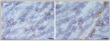 Click here to view Large Figure 1 biomedres-openaccess-journal-bjstr