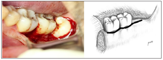 Click here to view Large Figure 2 biomedres-openaccess-journal-bjstr