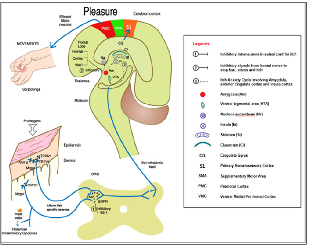 Click here to view Large Figure 1 biomedres-openaccess-journal-bjstr