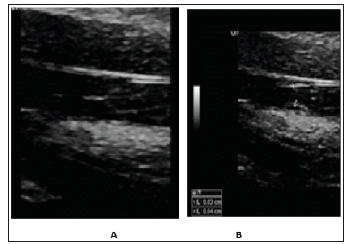Click here to view Large Figure 2 biomedres-openaccess-journal-bjstr