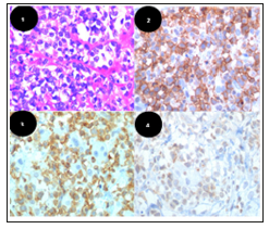 Click here to view Large Figure 1 biomedres-openaccess-journal-bjstr