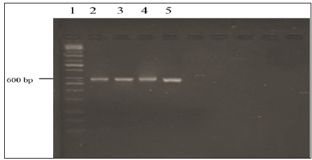 Click here to view Large Figure 3 biomedres-openaccess-journal-bjstr