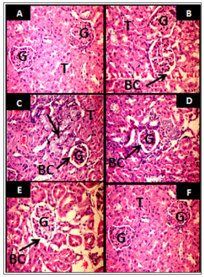Click here to view Large Figure 11 biomedres-openaccess-journal-bjstr