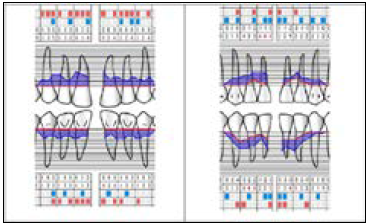 Click here to view Large Figure 7 biomedres-openaccess-journal-bjstr