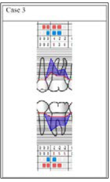 Click here to view Large Figure 13 biomedres-openaccess-journal-bjstr