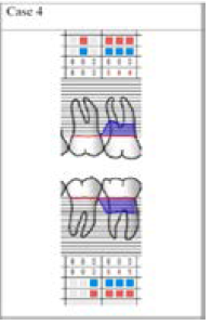 Click here to view Large Figure 16 biomedres-openaccess-journal-bjstr