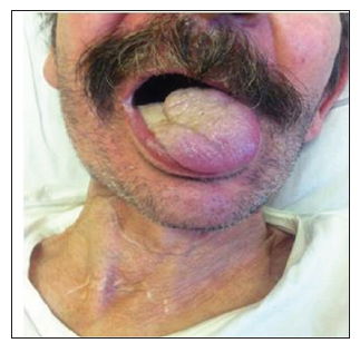 biomedres-openaccess-journal-bjstr