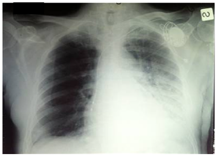 biomedres-openaccess-journal-bjstr